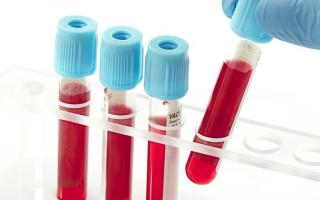 Какая группа крови будет у ребенка в зависимости от группы крови родителей